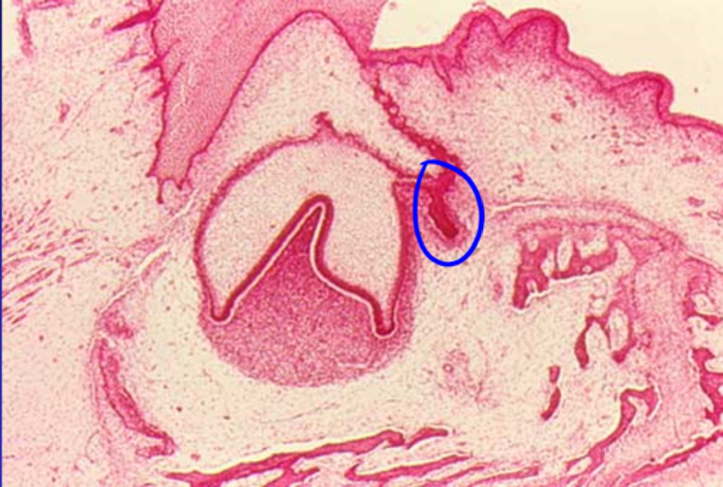 <p>Extension of dental lamina to lingual side of each tooth, go through enamal organ stages to form permanent incisors, canines, and premolars</p>