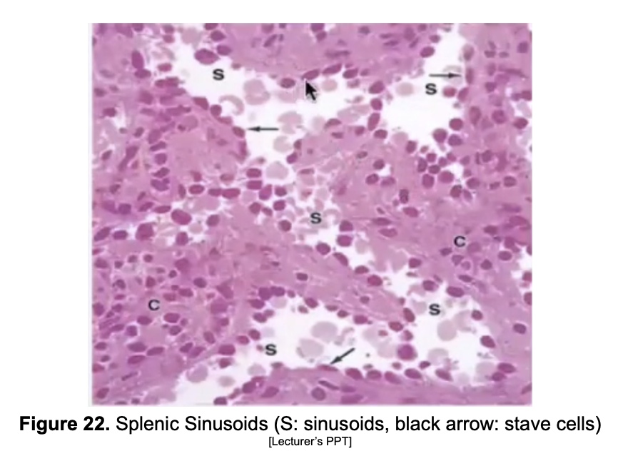 <p>Spleen </p><p>RED pulp</p>