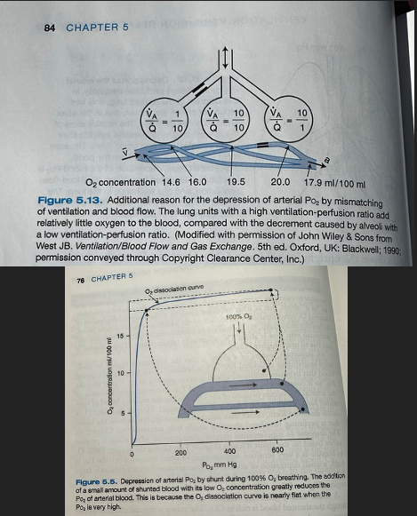 <ul><li><p><span>Three groups of alveoli with low, normal, and high ventilation-perfusion ratios</span></p></li><li><p><span>Even though there is an equal number of low and high ventilation-perfusion ratio alveoli, the high ventilation-perfusion ratio alveoli cannot compensate for the problems caused by the low ventilation-perfusion units due to decreased amount of blood flow to the alveoli</span></p></li><li><p><span>Due to the nonlinear shape of the oxygen dissociation curve, units with a high ventilation-perfusion ratio do not increase the oxygen concentration of the blood very much despite the relatively high PO2 (high ventilation-perfusion ratio = good ventilation and poor blood flow, blood going by well oxygenated but not much going by, when mixed with capillaries from other alveoli, contributes small amount of overall O2 to the mixture)</span></p></li><li><p><span>This explanation doesn't apply to the elevation of the PCO2 because the CO2 dissociation curve is almost linear in the working range</span></p></li></ul><ul><li><p><span>Net result is depression of the arterial PO2 below that of the mixed alveolar PO2 - alveolar-arterial PO2 difference</span></p><ul><li><p><span>In the healthy lung this difference is of trivial magnitude, only ~4mmHg due to ventilation-perfusion inequality</span></p></li></ul></li></ul><p></p>