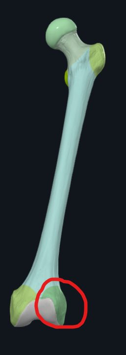 <p>What is this called?</p>