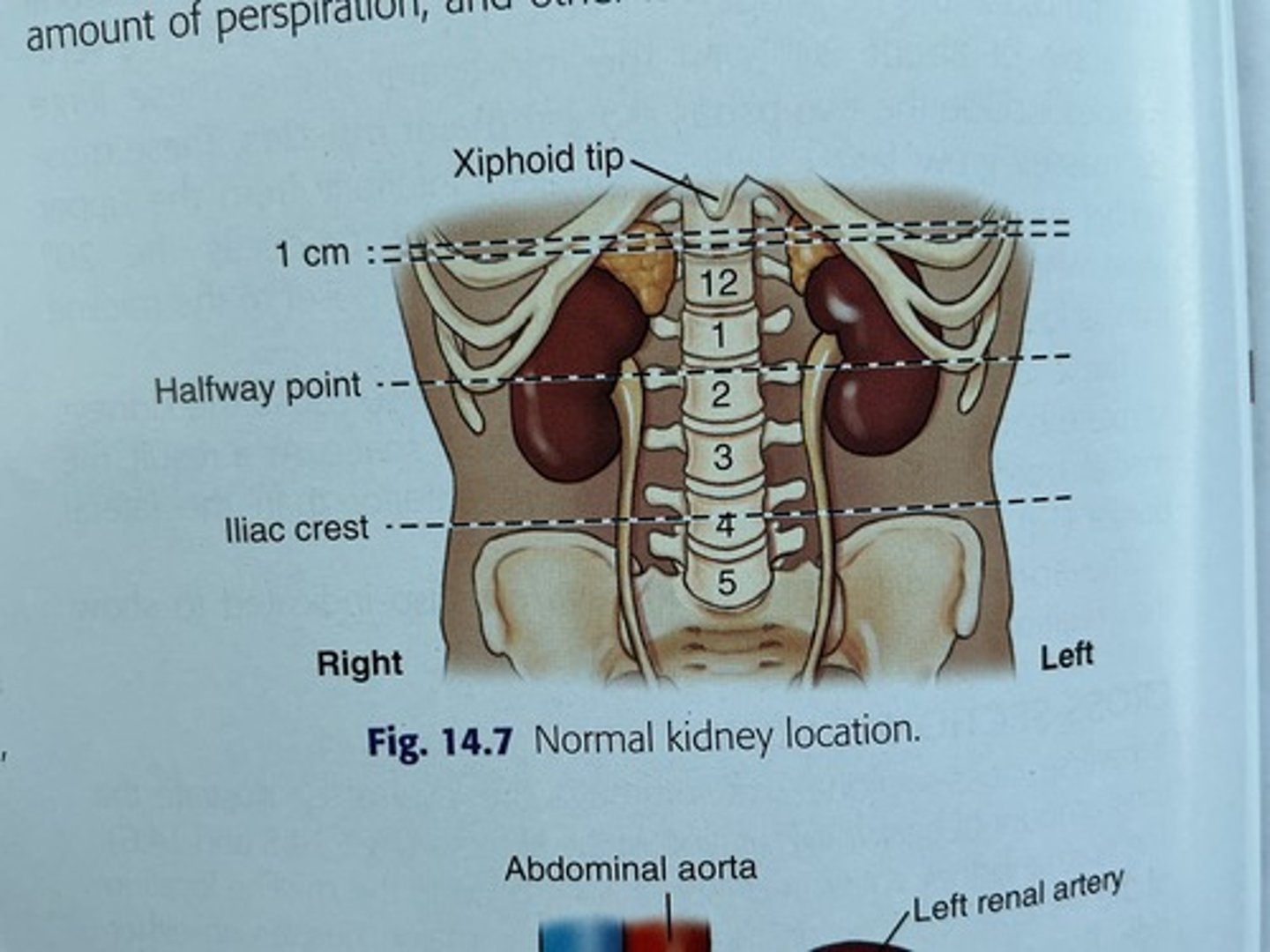 <p>Xiphoid and iliac crest</p>