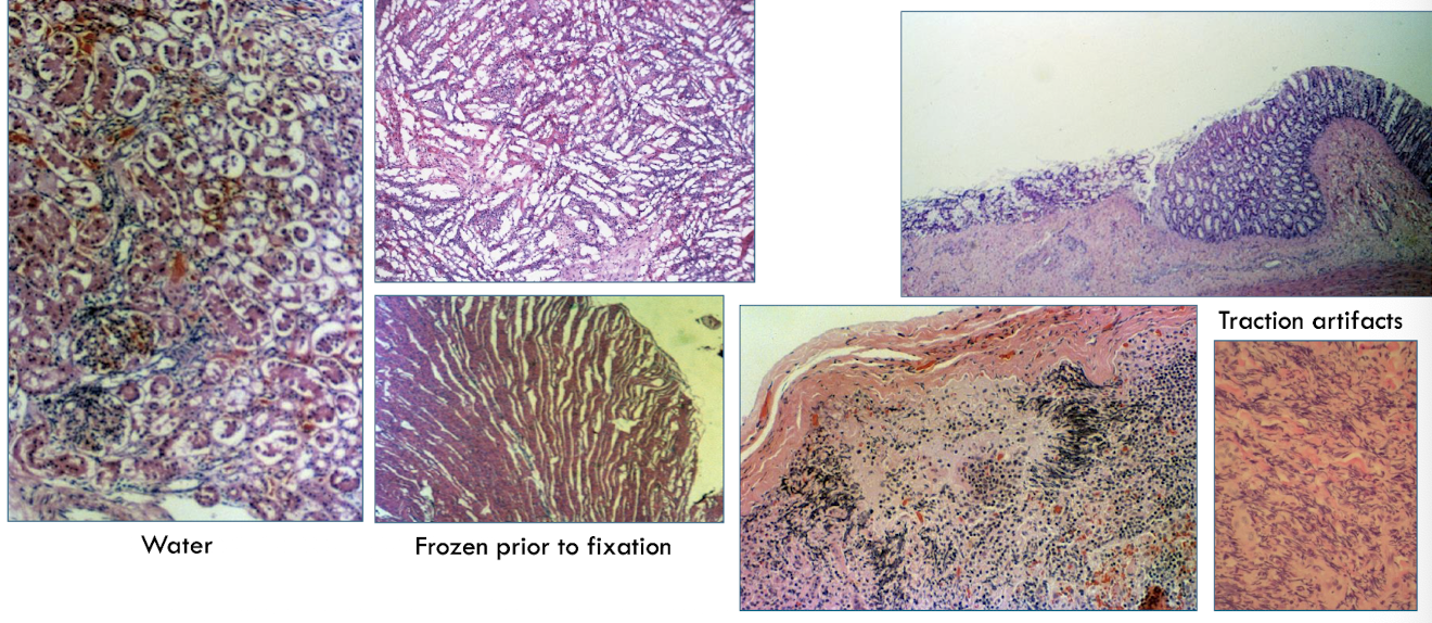 <ul><li><p>water</p></li><li><p>frozen prior to fixation</p></li><li><p>traction artifacts</p></li></ul><p></p>