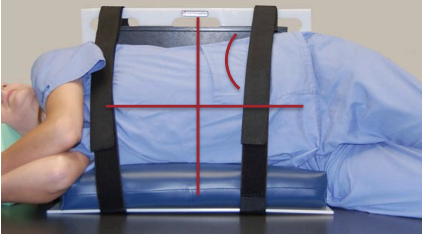 <ul><li><p>Collimate to field of view or collimate on all 4 sides to anatomy of interest</p></li><li><p>Must include elevated side of abdomen</p></li></ul><p></p>