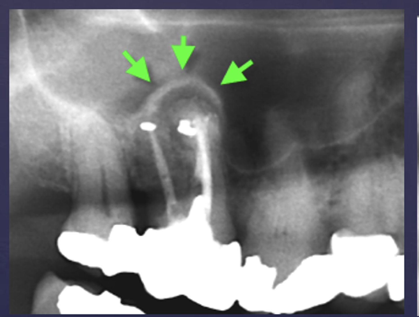 <p>What are the arrows pointing to?</p>