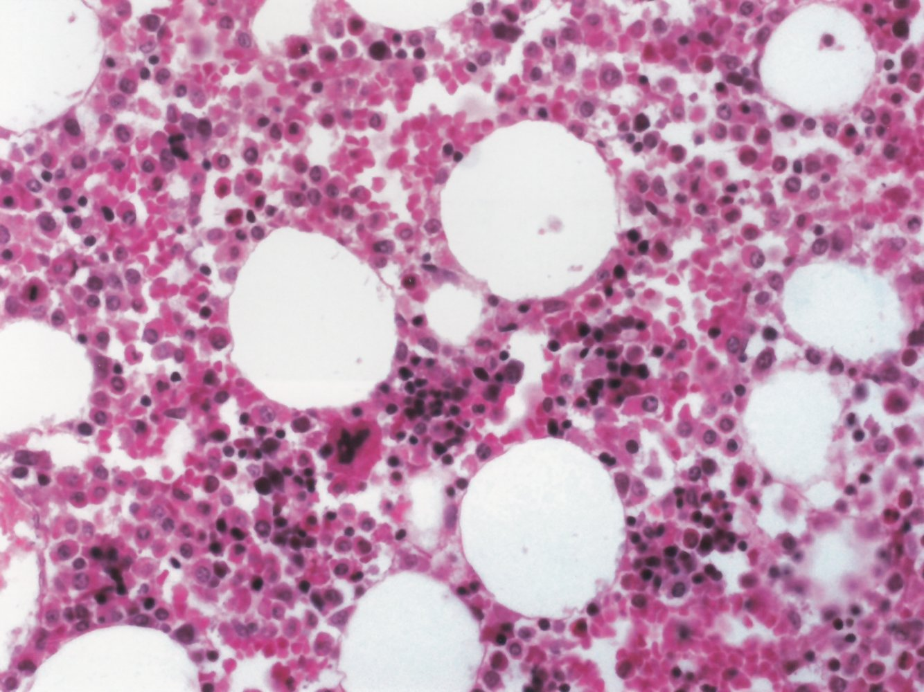 <p>A. Bone marrow</p>