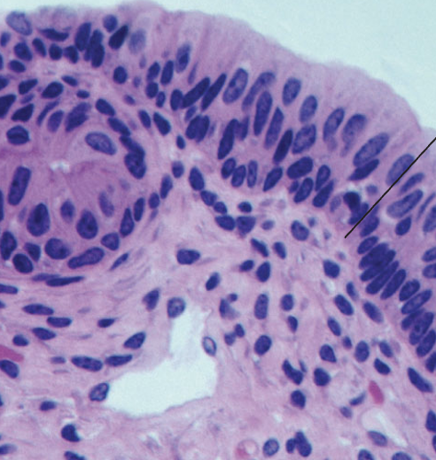 <p>What tissue type does this image depict?</p>
