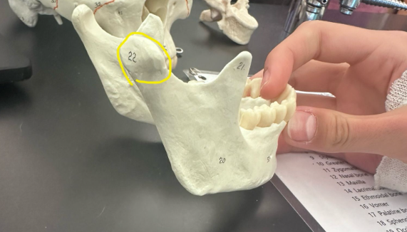 <p>What is circled in yellow? Or labeled as 22?</p>