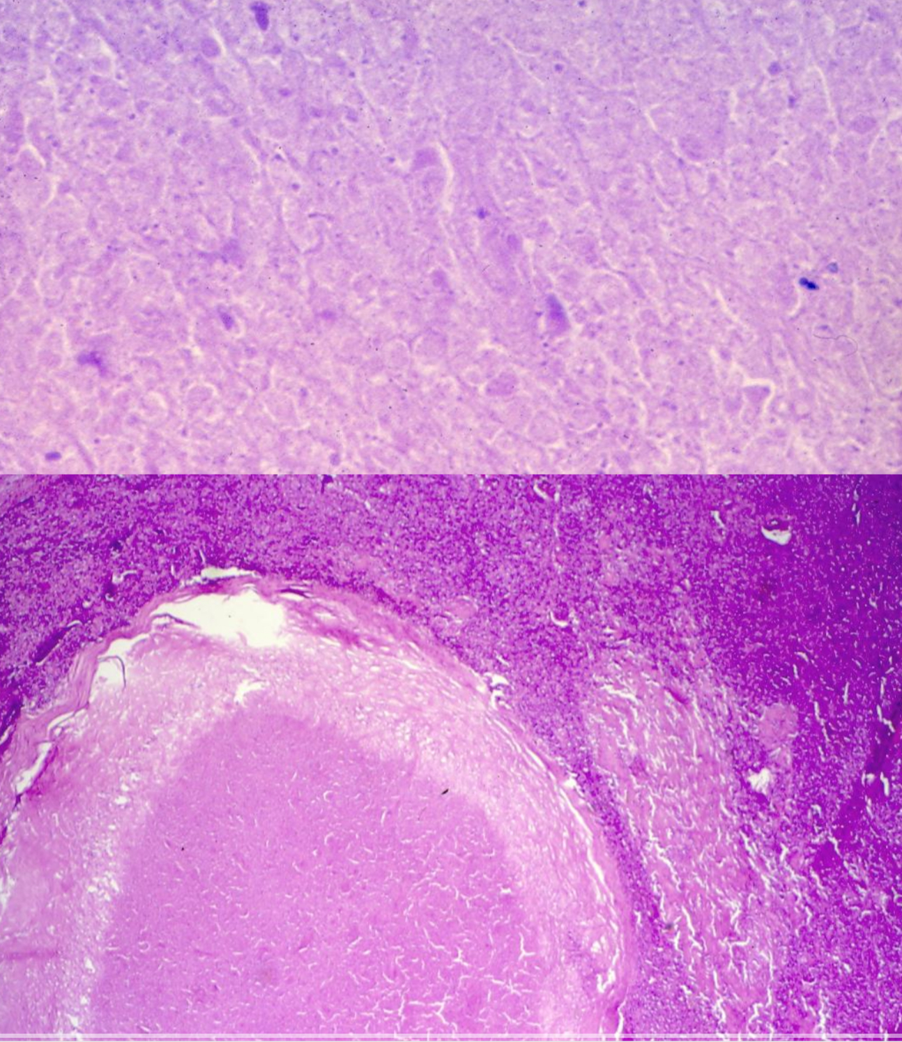 term image