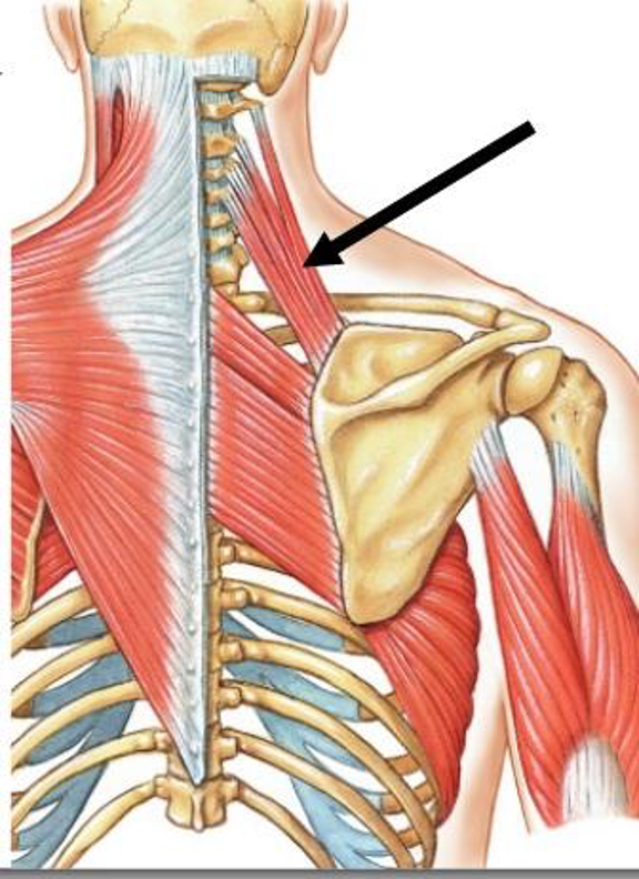 <p><strong>origin: </strong>C1-C4 transverse processes</p><p><strong>insertion:</strong> scapula</p><p><strong>innervation:</strong> C3-C5</p><p><strong>action:</strong> elevate scapula</p>