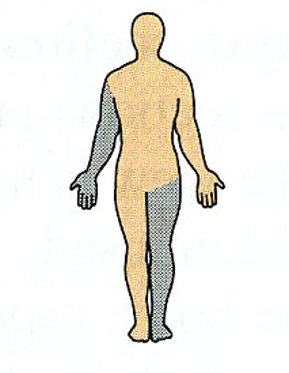 <p>on the opposite side of the body from a particular side of the nervous system</p><p>L hand is contralateral to the R hemisphere of the brain</p>