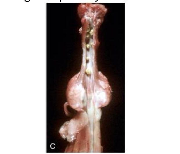 <p>what type of calculi is this?</p>