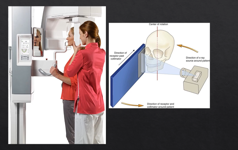 <p>as the X rays are produced at the detector they are columnated to an envelope shaped beam - see image where the X rays are produced </p>