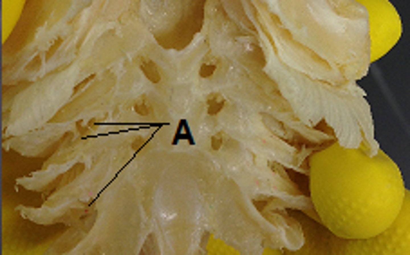 <p>Prevent debris/food from damaging gill filaments — Projections lining inner edge of gill arch</p>