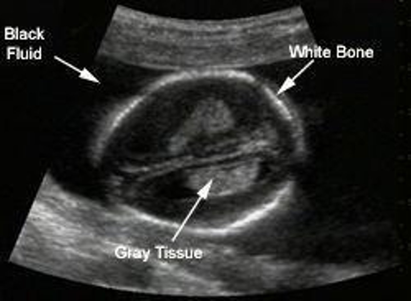 <p>Different colors on an ultrasound image represent varying levels of tissue density and blood flow.</p>