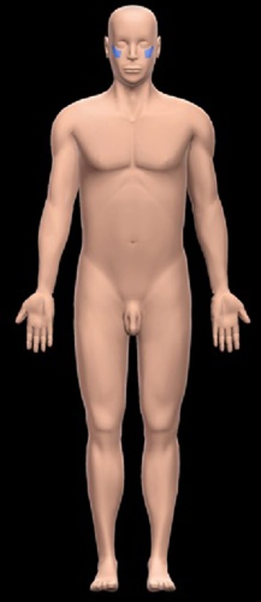 <p>Location:</p><p>Head (lateral)</p><p>Inferior to orbital region</p><p>Superior to buccal region</p><p>Description:</p><p>Part of cranial region related to zygomatic bone</p>