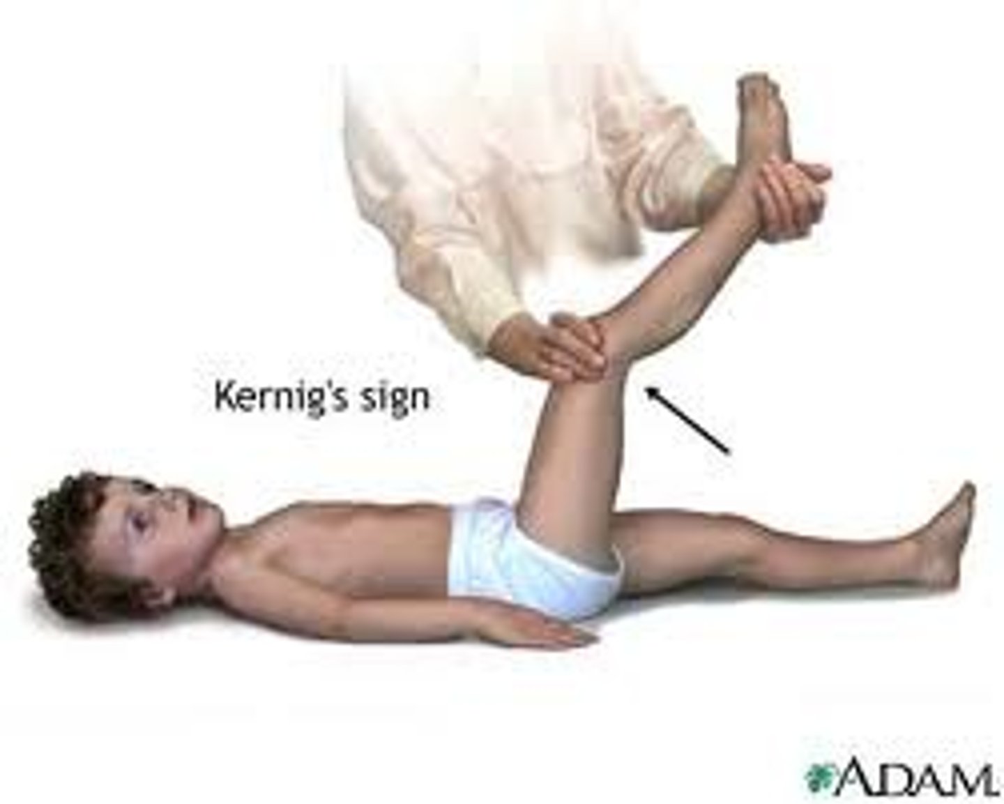 <p>test for meningitis</p><p>After flexing the hip and knee at 90 degree angles, pain and resistance are noted.</p>