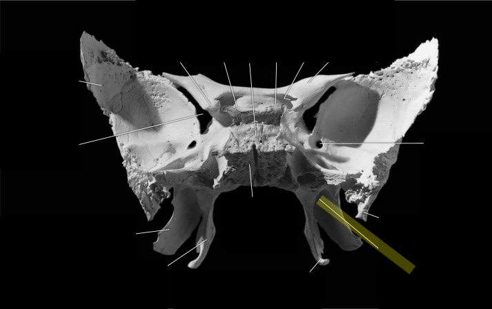 <p>What is the structure?</p>