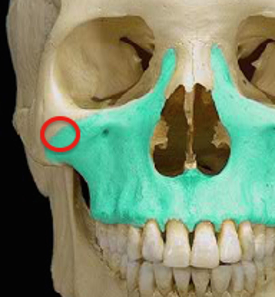 <p>forms much of the cheek, articulates with zygotmatic</p>