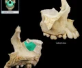 <p>largest paranasl sinus; pyramidal; on cheek bone lateral to nasal bone Drains into middle nasal meatus Common site of sinus infection Contributes to voice resonance Paranasal sinuses include: frontal, maxillary, and sphenoidal sinuses, and ethmoidal cells (sinus)</p>