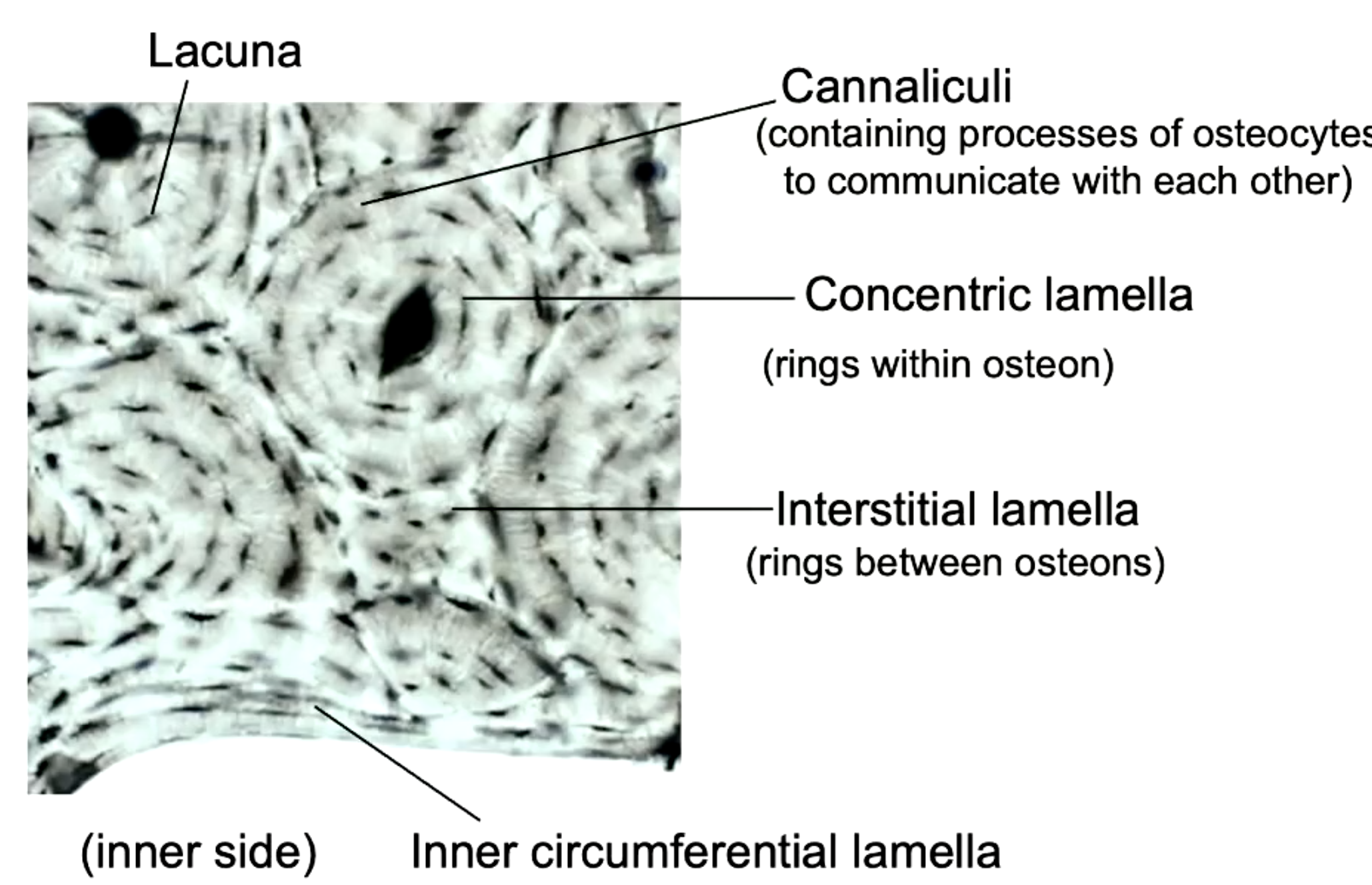 <p>concentric lamella</p>