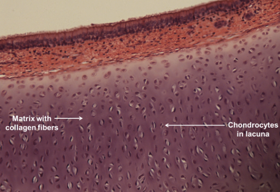 <p>connective tissue; contains collagen fibers; chondrocyte in lacunae; located in the ends of long bones</p>