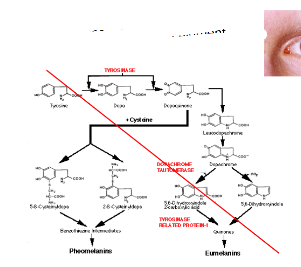<p>- absence of melanin pigment</p><p>- tyrosine is a melanin precursor</p>