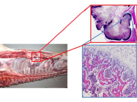 <p>Patho Ostéochondrome/Ostéochondromatose</p>