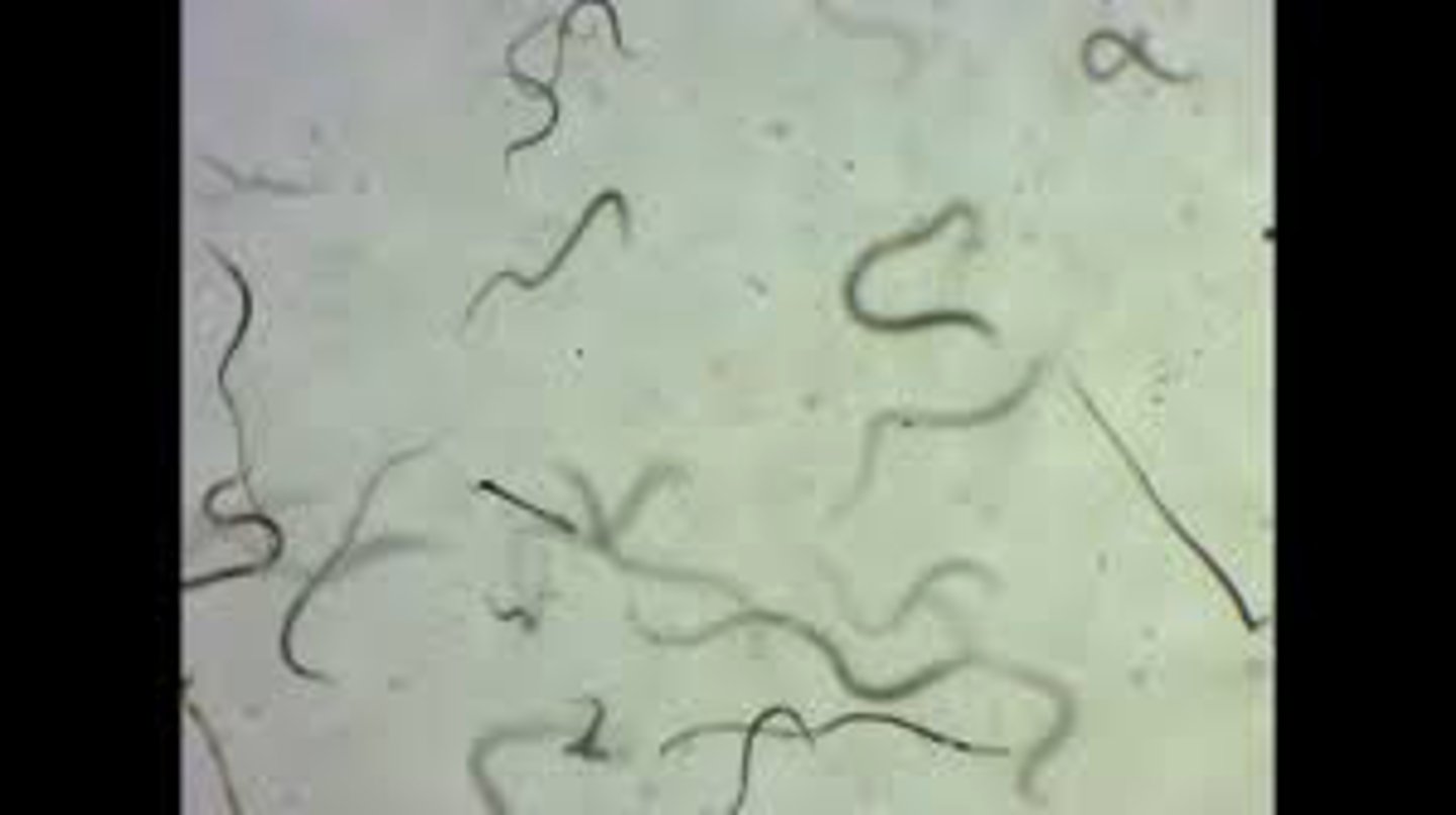 <p>Free living</p><p>Random Movement</p><p>Only possesses longitudinal muscles (lacks circular motion)</p>