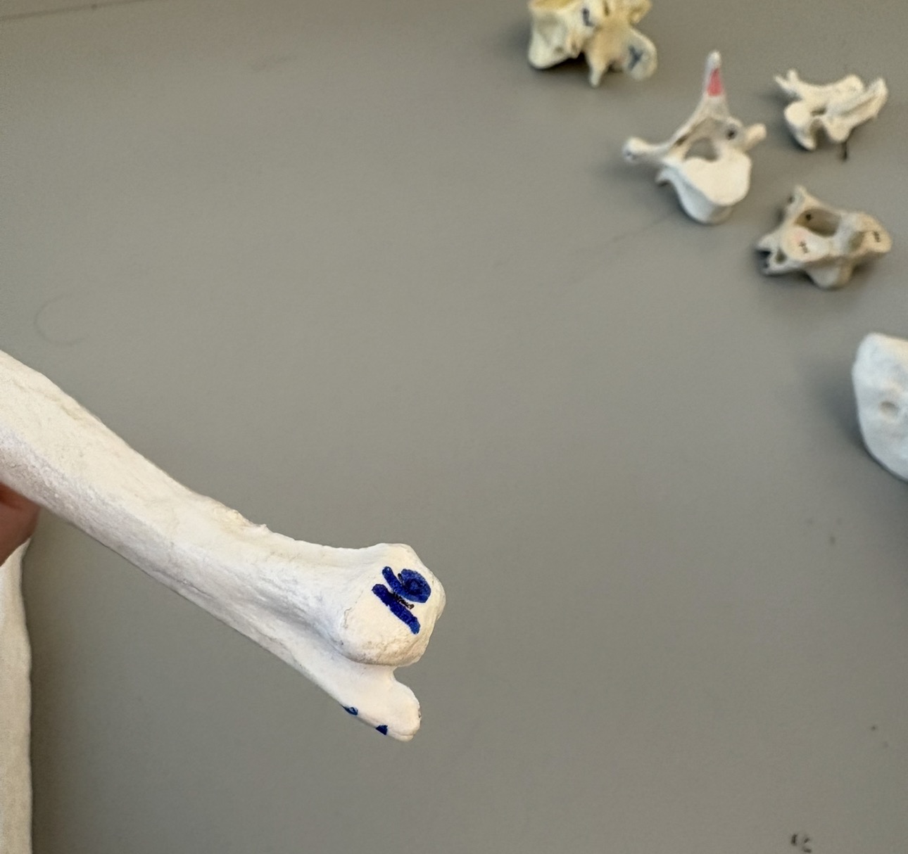 <p>what is 16 of the ulna?</p>