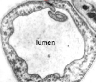 <p>What type of capillary is this image?</p>
