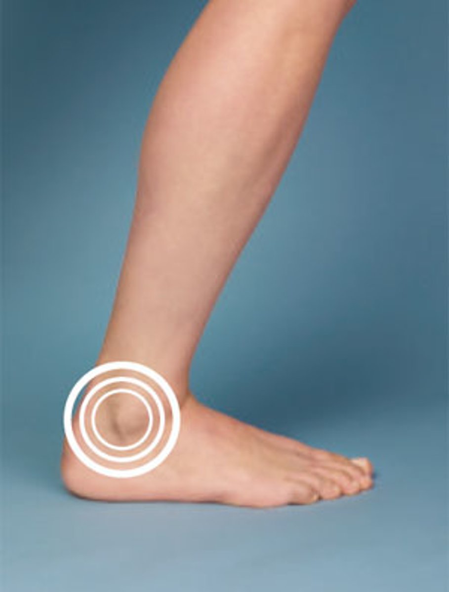 <p>ankle</p>