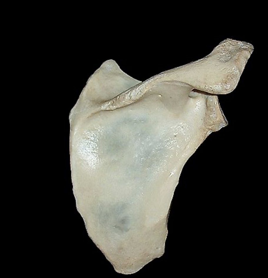 <p>What bone is this? What view?</p>