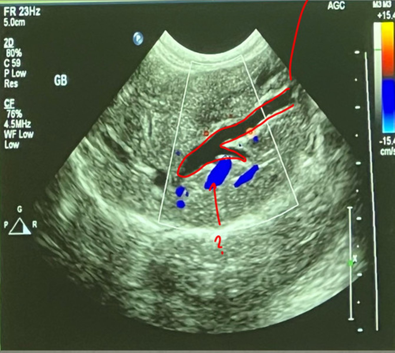 <p>what duct is being shown with the red outline?</p>