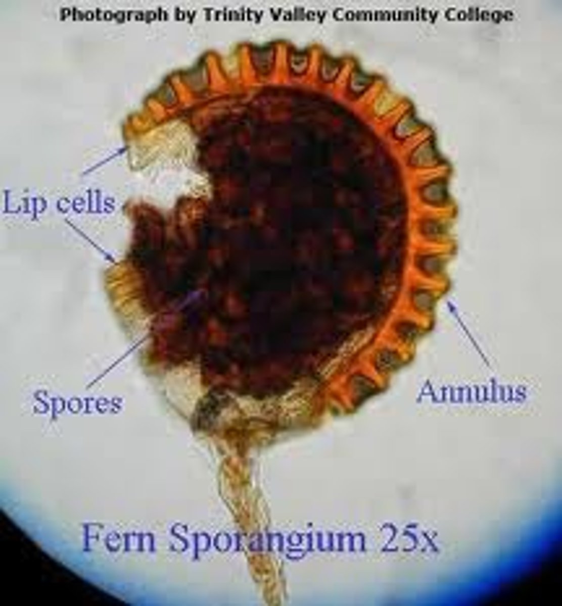 <p>reproductive sac that contains spores</p>