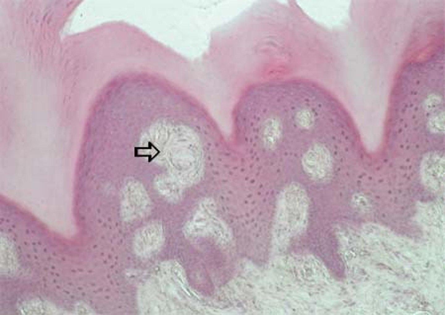<p>light touch, in papillary layer of skin</p>