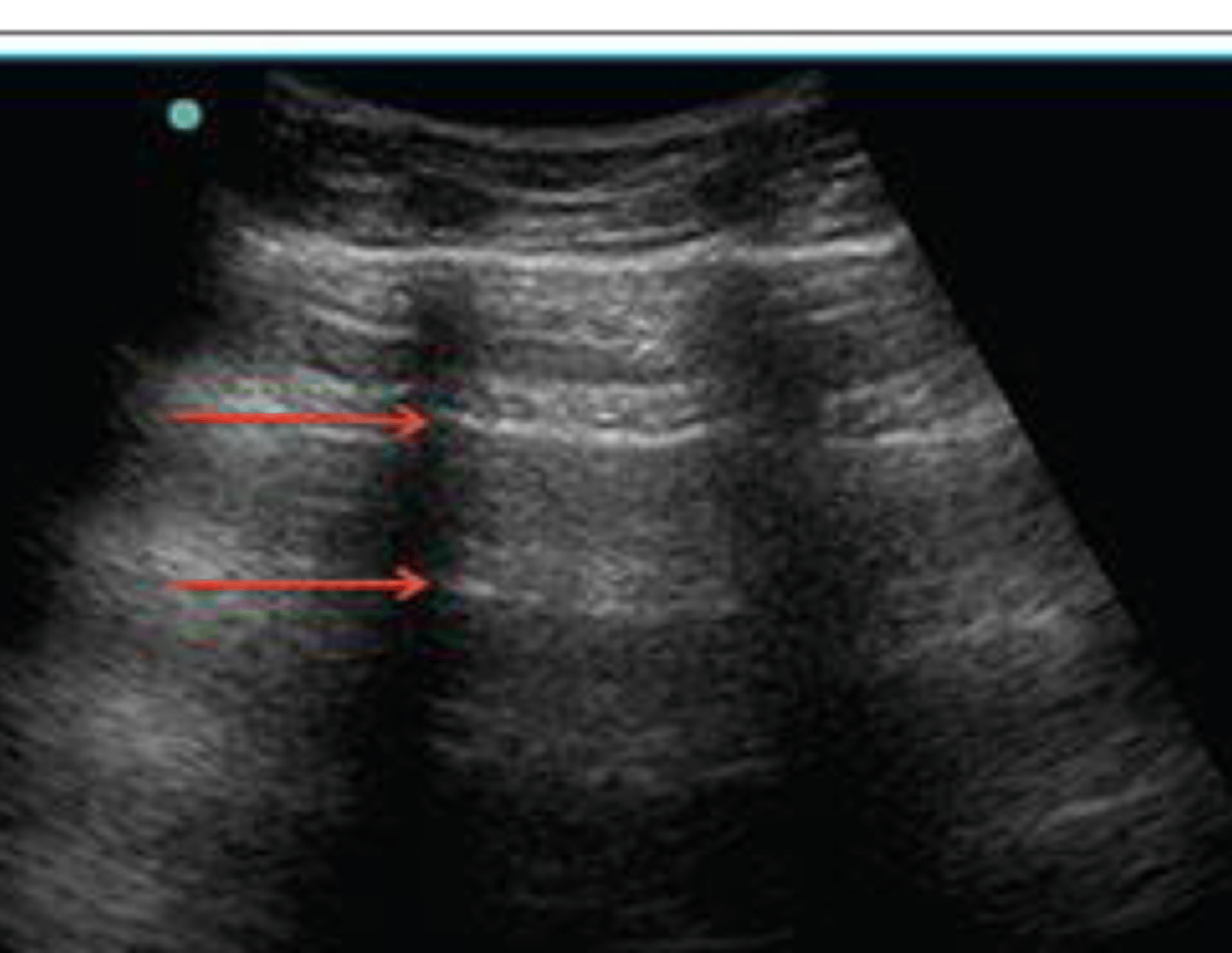 <p>what is the arrow pointing to</p>