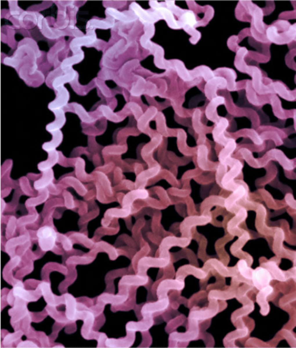 <p><u>Prokaryotic Cells</u></p><p>Spiral-shaped bacteria.</p>