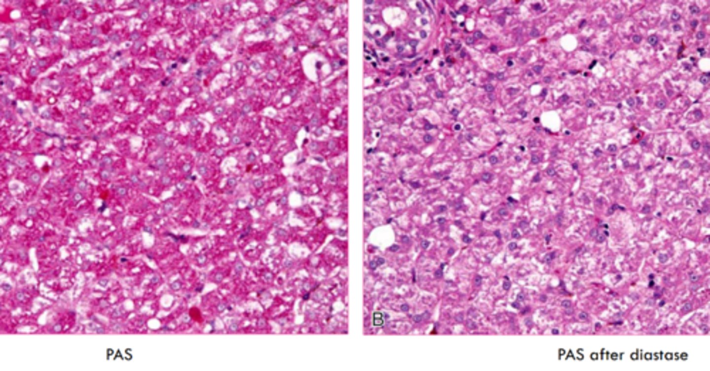 <p>periodic acid - schiff stain</p>