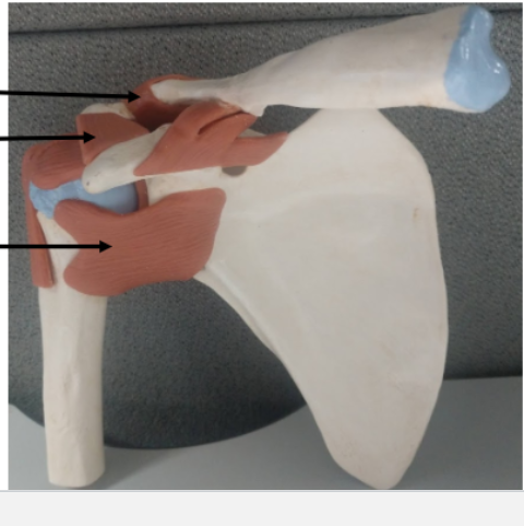 <p>What is the middle arrow pointing at on the shoulder?</p>