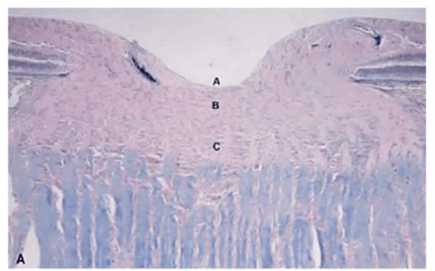 <p>Label each histological component of the longitudinal section of the optic nerve head (A, B, C)</p>