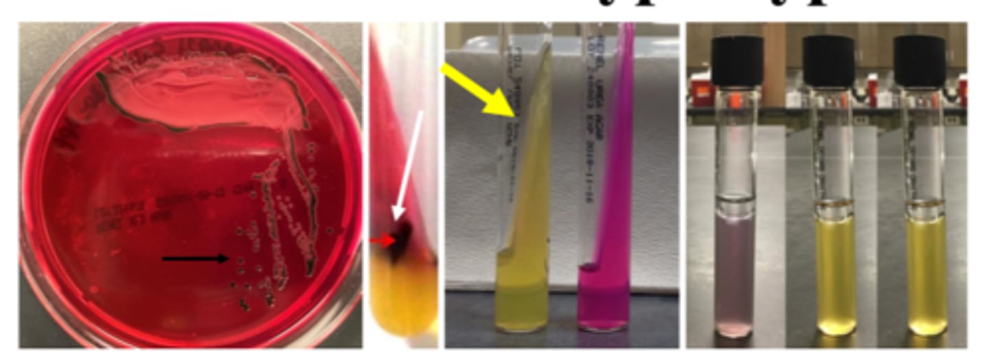 <p>-Non-lactose fermentation</p><p>-Growth on highly selective agar</p><p>-H2S-positive (crescent ring)</p><p>-Urease-negative</p><p>-Phenylalanine-negative</p><p>-can decarboxylate lysine (NOT arginine or ornithine)</p><p>-typhoid fever</p><p>-motile</p>