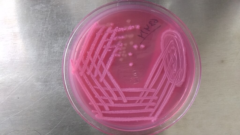 <p>Identify this organism:</p><p>TSI: A/A</p><p><strong>Motility: +</strong></p><p><strong>Indole: +</strong></p><p><strong>Ornithine: +</strong></p><p><strong>CIT: -</strong></p><p>LYS: -</p><p>PD: -</p>