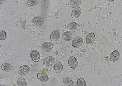 <p>what parasite is this</p>