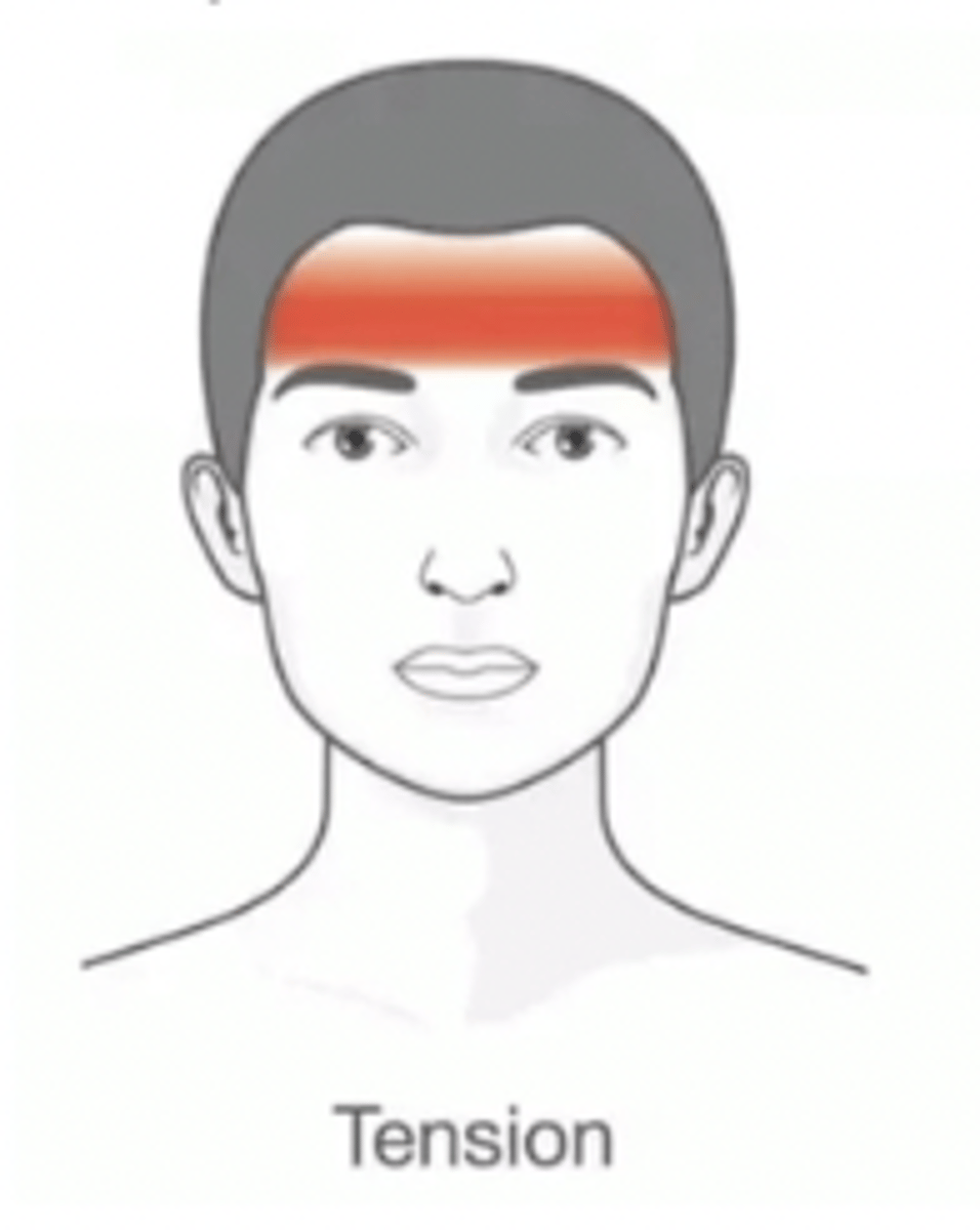 <p>bilateral (bifrontal)</p>