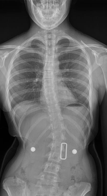 <p>Name this pathology</p>