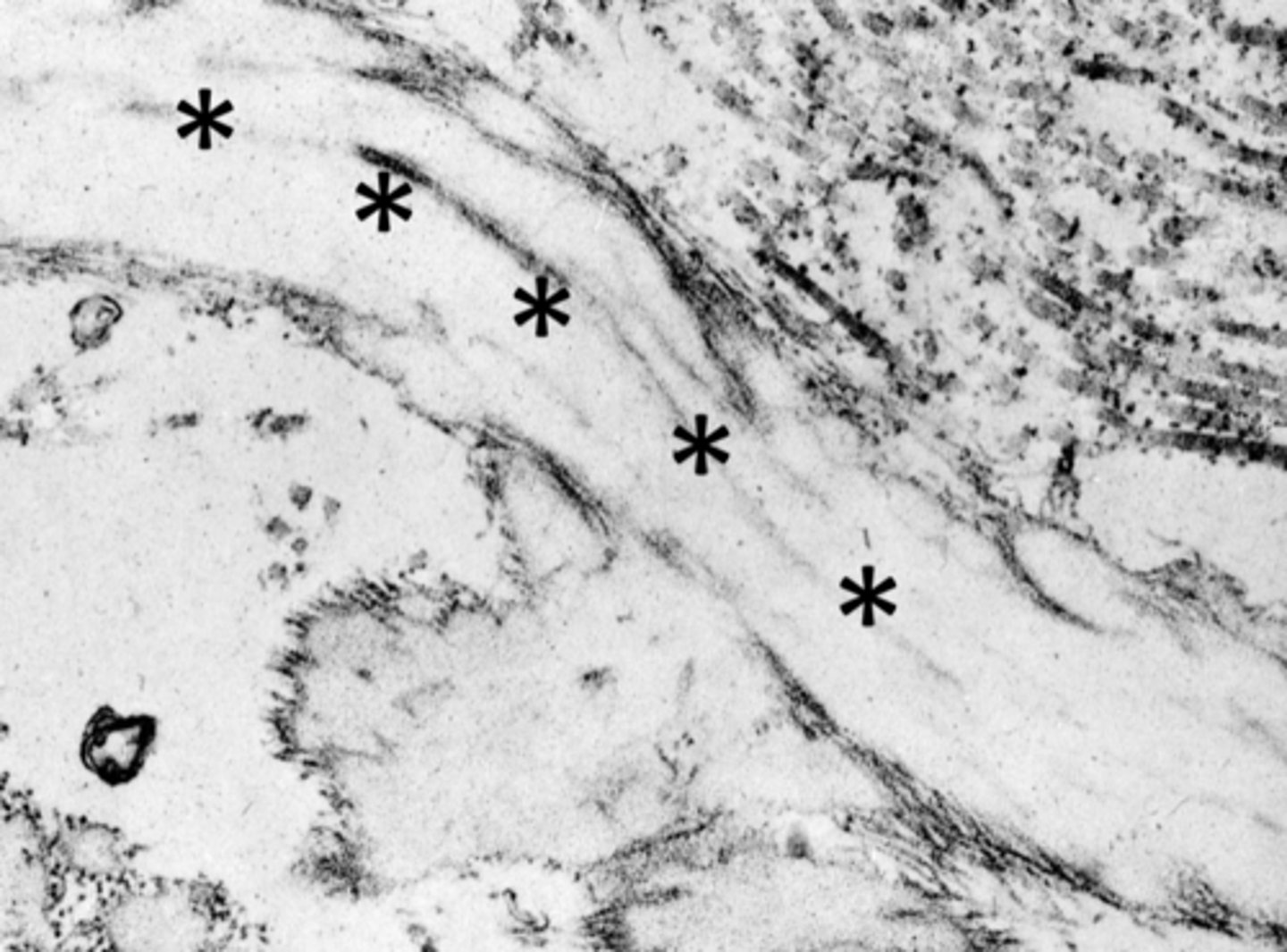 <p>What are the arrows pointing to in this electron micrograph?</p>