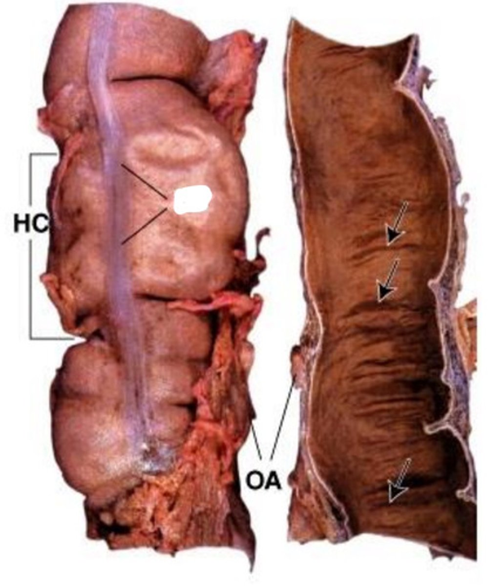 <p>taenia coli</p>