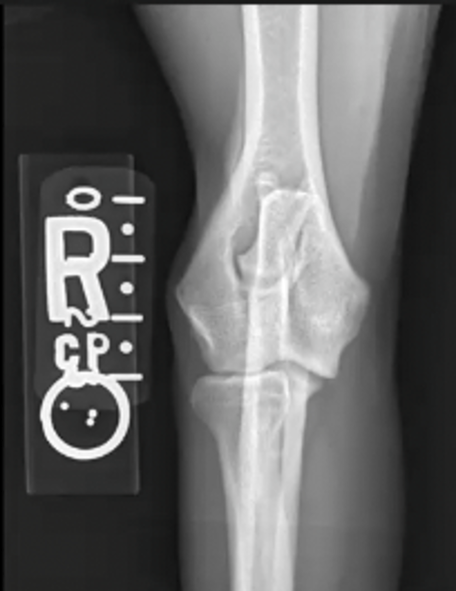 <p>What is the view of this image?</p>