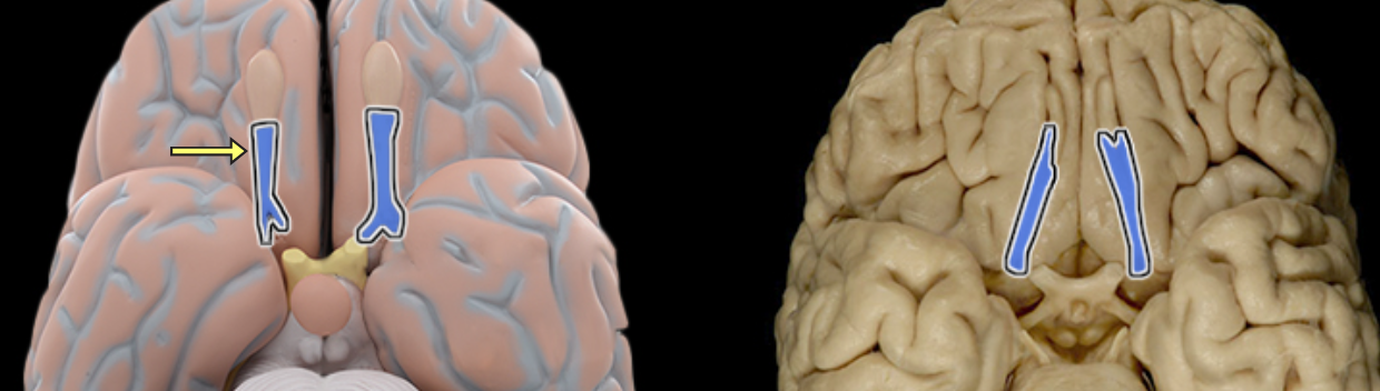 <p>Location:</p><ul><li><p>Ventral aspect of frontal lobe</p></li><li><p>Between olfactory bulb and medial aspect of temporal lobe</p></li></ul><p>Description:</p><ul><li><p>Bundles of afferent and efferent axons</p></li></ul><p></p>