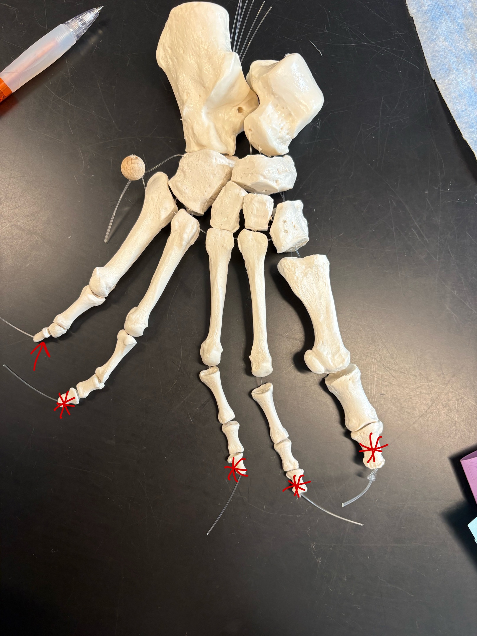 <p>Name these bones</p>